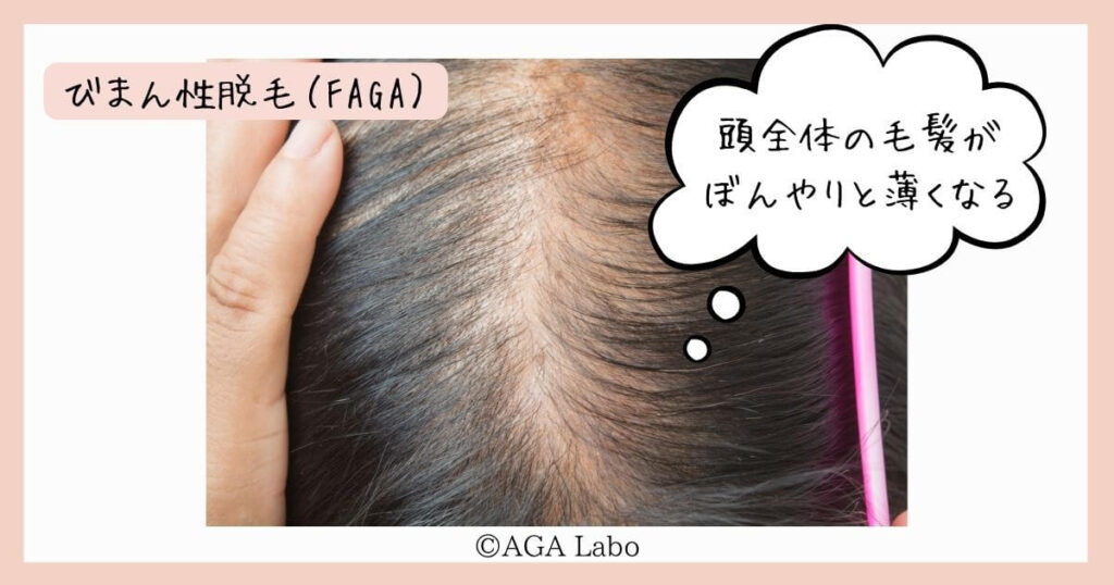 wat is faga?